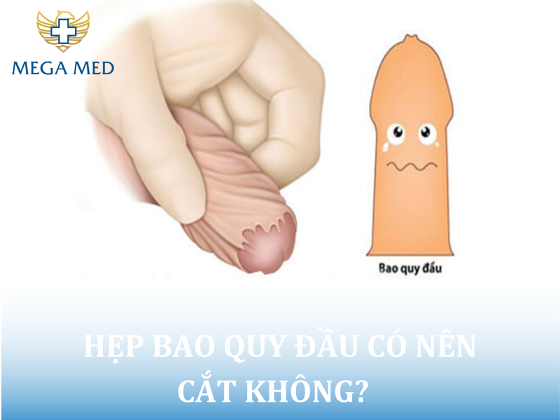 Hẹp bao quy đầu có nên cắt không? Có sao không?
